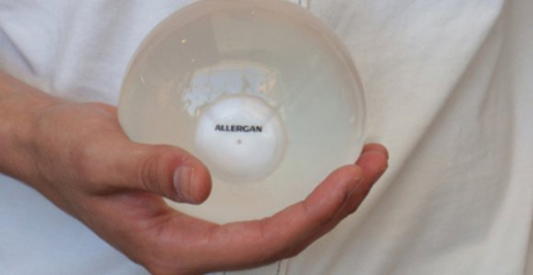 Balón intragástrico: Selección y preparación previa del paciente