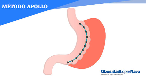 ¿En qué consiste el Método Apollo?